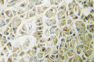 AP20560PU-N - Granzyme H (GZMH)