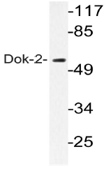 AP20563PU-N - DOK2 / p56 dok2