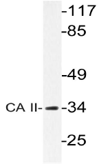 AP20569PU-N - Carbonic anhydrase 2