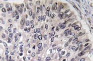 AP20569PU-N - Carbonic anhydrase 2
