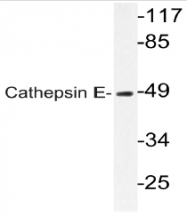 AP20573PU-N - Cathepsin E