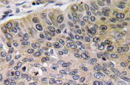 AP20573PU-N - Cathepsin E