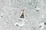 AP20574PU-N - Adrenomedullin / ADM
