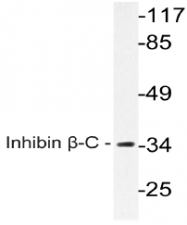 AP20576PU-N - Inhibin beta C chain (INHBC)