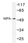 AP20366PU-N - ZC3HC1