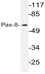 AP20584PU-N - PAX8