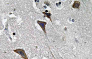 AP20585PU-N - CD295 / Leptin Receptor