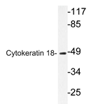 AP20358PU-N - Cytokeratin 18
