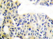 AP20358PU-N - Cytokeratin 18