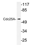 AP20356PU-N - CDC25A