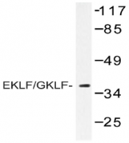 AP20438PU-N - Krueppel-like factor 1 (KLF1)