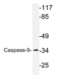 AP20355PU-N - Caspase-9