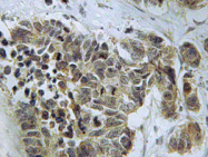 AP20355PU-N - Caspase-9