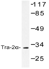 AP20440PU-N - TRA2A