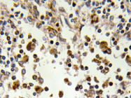 AP20352PU-N - RPS6KA5 / MSK1