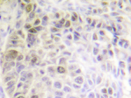 AP20349PU-N - XRCC6 / Ku70