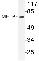 AP20443PU-N - MELK