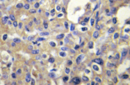 AP20443PU-N - MELK