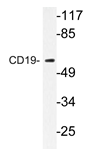 AP20344PU-N - CD19