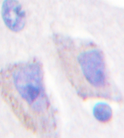 AP20343PU-N - AMPK beta-1 chain / AMPKb