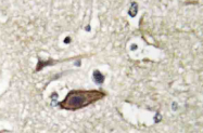 AP20455PU-N - TSG101
