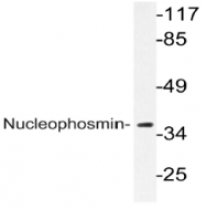 AP20457PU-N - Nucleophosmin