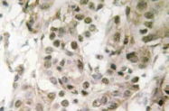 AP20457PU-N - Nucleophosmin