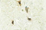 AP20458PU-N - BHLHB3 / BHLHE41