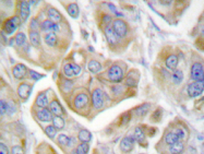 AP20337PU-N - CD104 / Integrin beta-4