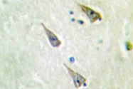 AP20459PU-N - SEMA4A
