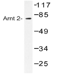 AP20460PU-N - ARNT2