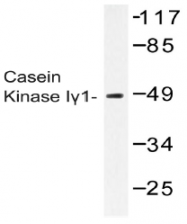 AP20461PU-N - CSNK1G1