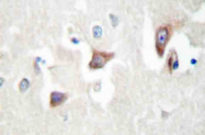 AP20465PU-N - CDC42BPB