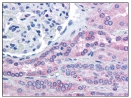 AP21522PU-N - Rhophilin 2 / RHPN2