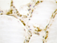 AP20331PU-N - Retinoblastoma-associated protein / RB1