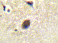 AP20328PU-N - RASGRF1