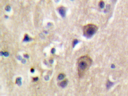 AP20325PU-N - Ryanodine receptor 2 / RYR2
