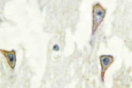 AP20473PU-N - Adenylate cyclase type 1