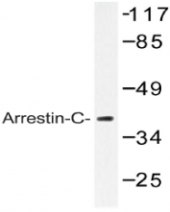AP20474PU-N - Arrestin C / ARR3