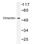 AP20321PU-N - Vimentin