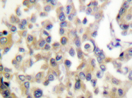 AP20321PU-N - Vimentin