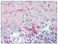 AM05628PU-S - VAMP-2 / Synaptobrevin-2