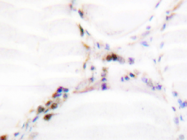 AP20319PU-N - Vitamin D3 receptor / NR1I1