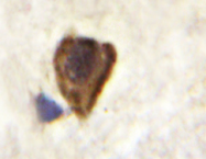 AP20314PU-N - CD140b / PDGFRB