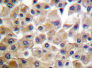 AP20313PU-N - CD140b / PDGFRB