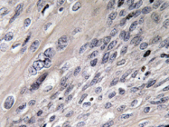 AP20312PU-N - ACO1 / IREB1