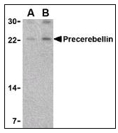AP07693PU-N - Cerebellin-1