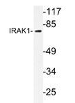 AP20311PU-N - IRAK1