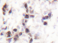 AP20305PU-N - hnRNP-C1/C2 / HNRNPC