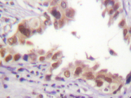 AP20304PU-N - Histone H3